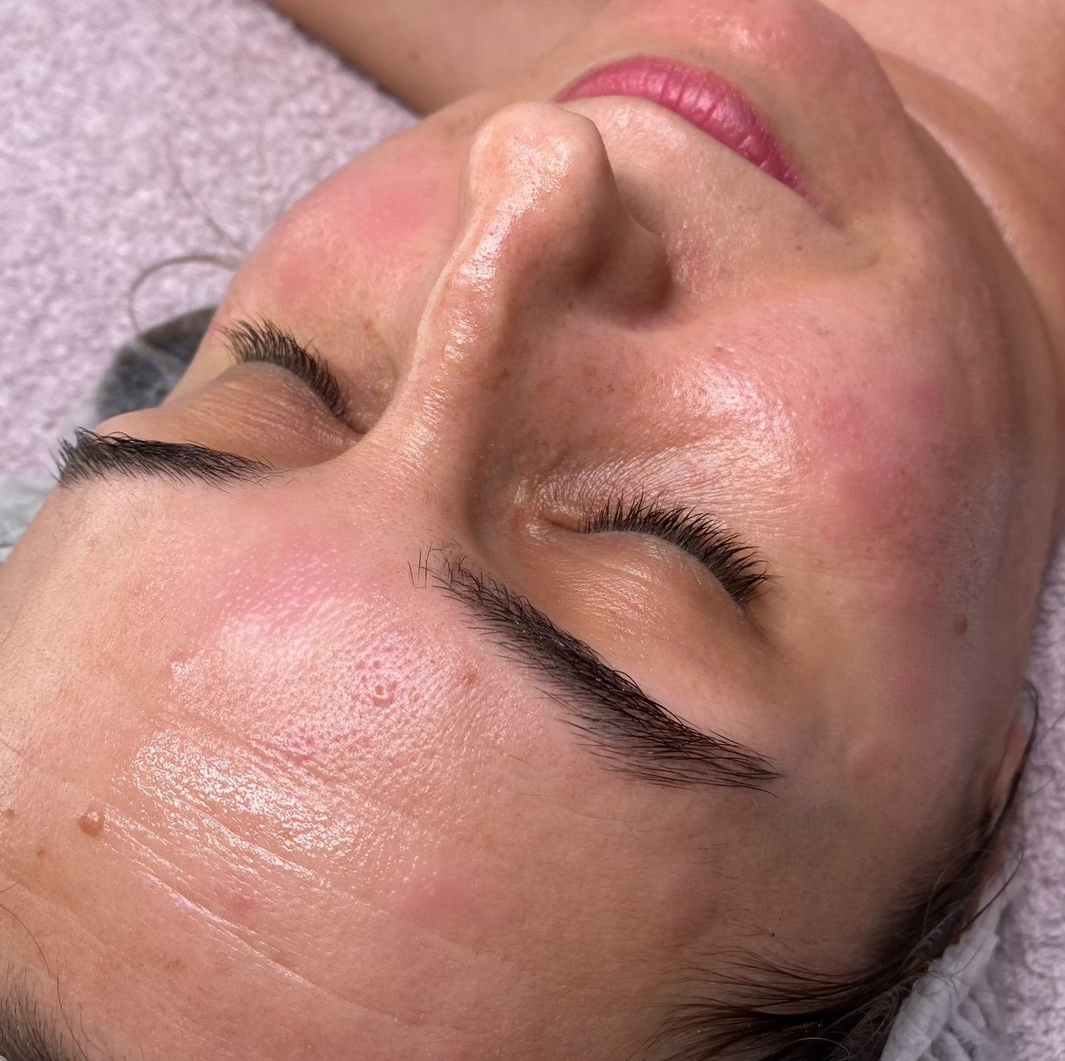 María Garcés Belleza Y Micropigmentación tratamiento facial