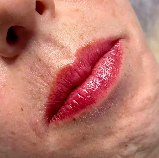 labios despues