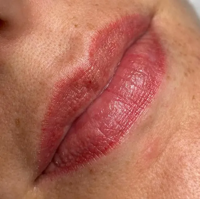 labios despues